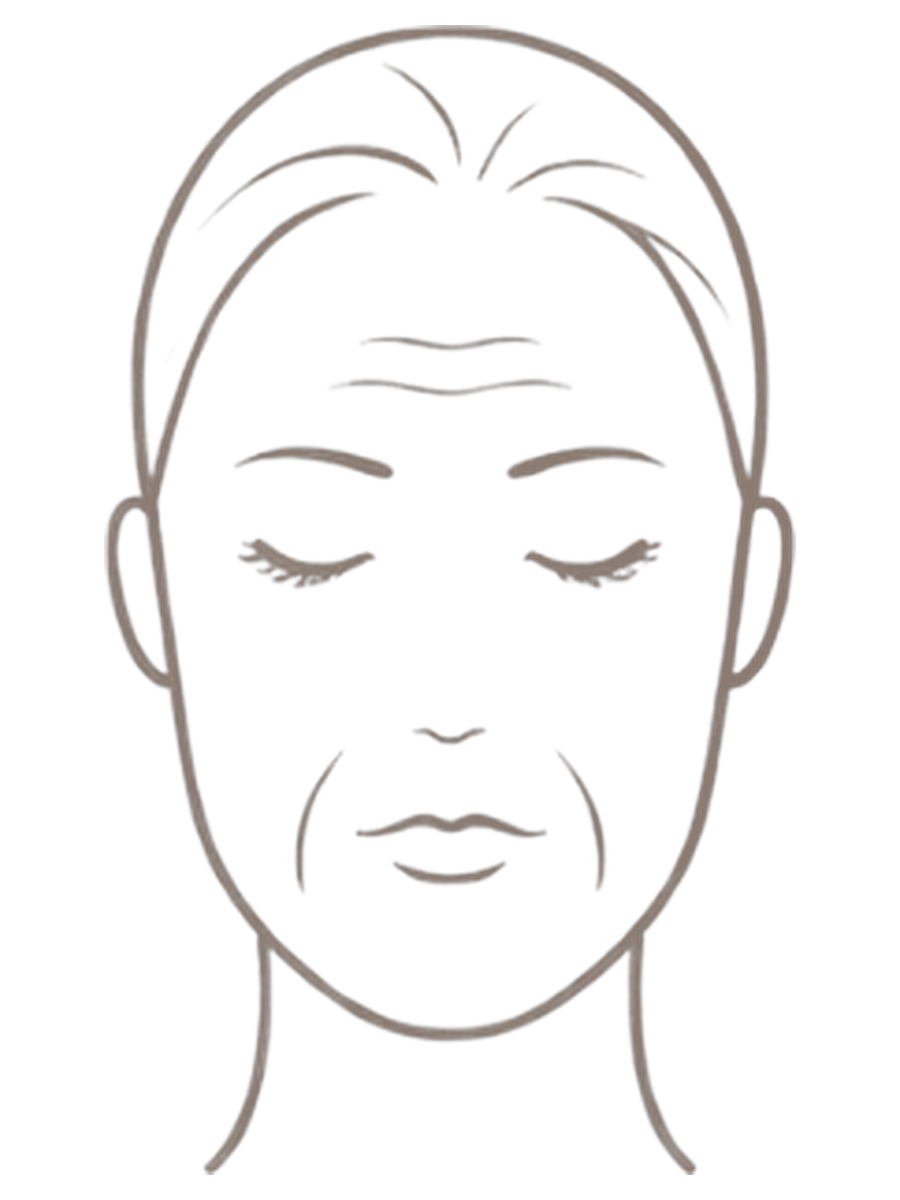 Lifting facial — antes